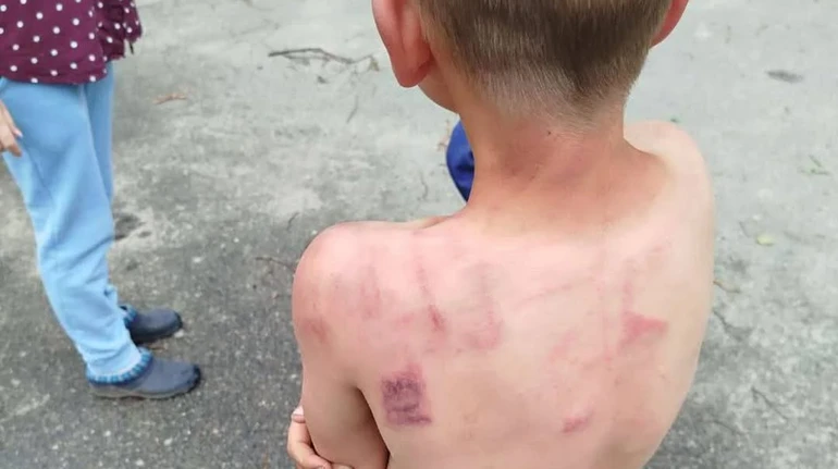 На Житомирщині батько виховує дітей кулаками: що про це кажуть у поліції