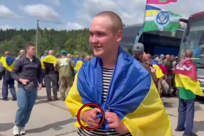 Росіяни відрубали полоненому українському військовому палець