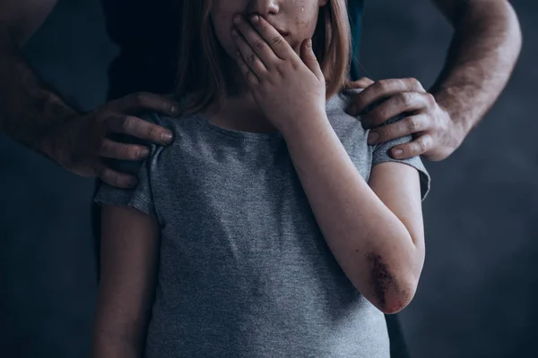 На очах у матері: чоловік в гуртожитку поглумився над 5-річною дівчинкою