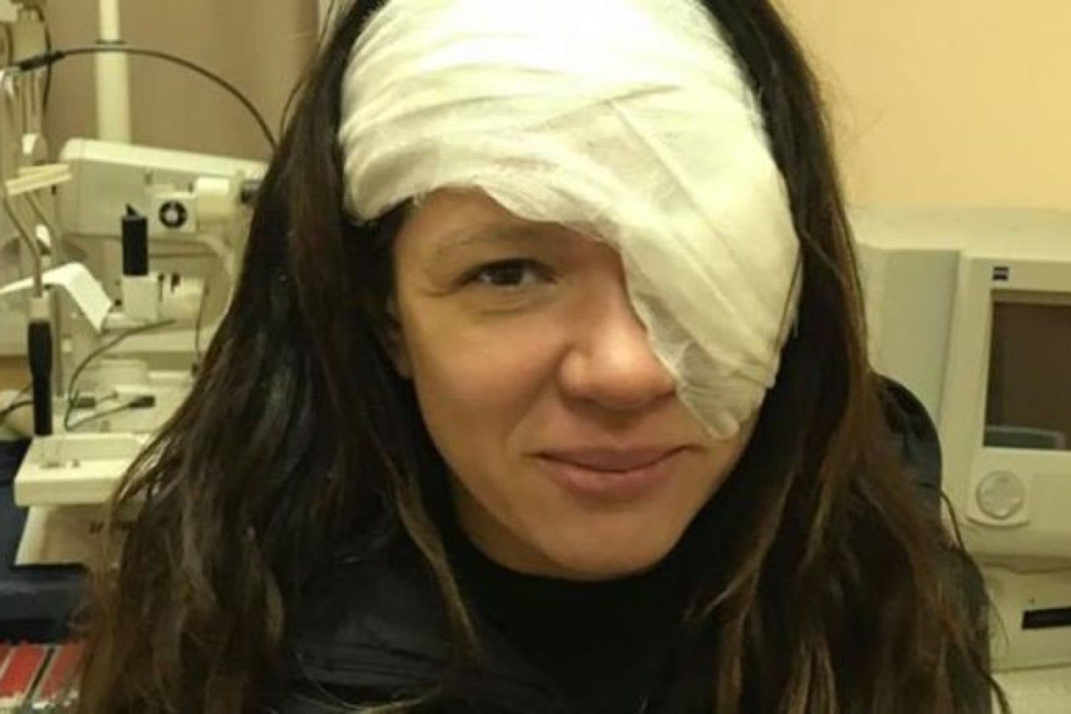 Кейт перенесла операцию. Девушка после операции глаза. Повязка на глаз после операции.