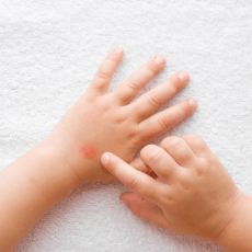 На Волині від укусів кліщів постраждала 21 дитина