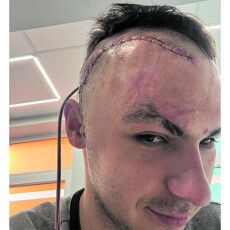 Герой з Волині: «Добре, що шолом  не застібнув, а то голову відірвало б»