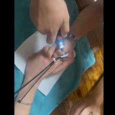 В обласному центрі Волині, щоб зняти каблучку, довелося викликати рятувальників