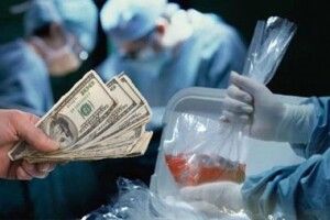 В українця забирали нирку за 15 тисяч доларів, а збували вже – за 150 тисяч «зелених»