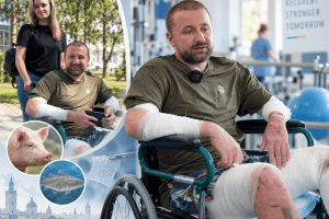 У Львові пацієнту пересадили шкіру свині і риби