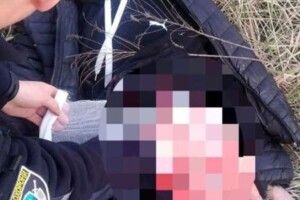 У Рівному 30-річний чоловік намагався накласти на себе руки