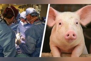 Людині вперше вдало пересадили нирку від… свині