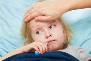 За два дні  захворіли на кір 19 юних ковельчан 