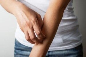 На Волині зареєстровано випадок підшкірного дирофіляріозу