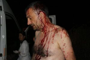 Схопили людей, що битами побили редактора газети