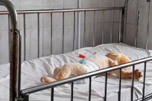 На Рівненщині 3-річний малюк підпалив ковдру 8-місячного брата: 25% тіла немовляти обпечено