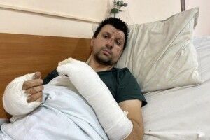 Вибухнув генератор: двом львів’янам пересадили шкіру після пожежі