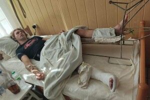 Мотоциклісту, якого знайшли в кюветі на Рівненщині, збирають гроші на операцію у Луцьку