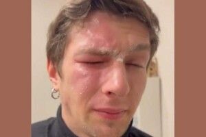 У Львові сусідка розпилила газовий балончик в обличчя ветеранові