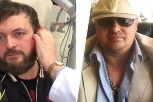 Дзідзьо оприлюднив фото того, хто на нього напав