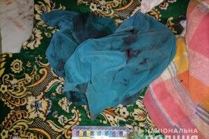 Чоловік молотком пробив голову коханій жінці (Фото 18+)