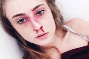 За зламаний ніс дочки волинянин відпрацює 160 годин громадських робіт