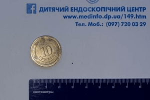 Ендоскопісти витягали зі стравоходу восьмирічної дитини 10-гривневу монету