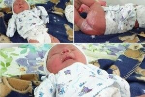 На Волині пара відмовилася від немовлятка з «крильцями»
