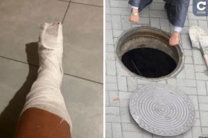 «Не пам'ятаю, скільки я там була»: відпочивальниця на прогулянці провалилася в люк із арматурою і сміттям 