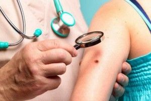 Лучан безкоштовно перевірятимуть на меланому і псоріаз 