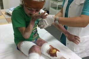 Жах: 7-річний хлопчик із опіками на заправці заробляв гроші на операцію (фото)