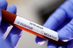 В інфекційній лікарні немає місць для хворих на коронавірус, – головний медик Луцька