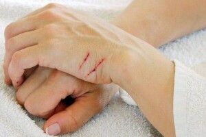Волинянку різати вени намовила оковита