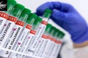 Мавпяча віспа вже в Польщі: ВООЗ оголосила надзвичайну ситуацію