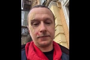 У центрі Києва побили журналіста Романа Вінтоніва (Майкла Щура)