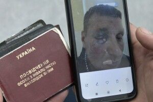 Волинські поліцейські продовжують розслідувати побиття ветерана в Луцьку