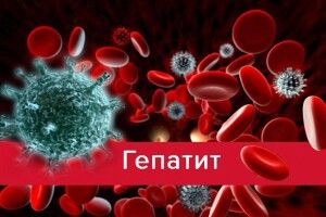 У Чернігові вже у 15 учнів підозрюють гепатит «А»