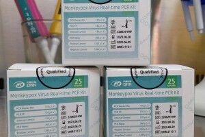 На Волинь надійшли тест-системи, які виявляють вірус мавпячої віспи