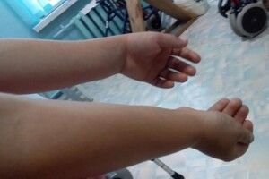 У Запорізькій області троє дітей підірвалися на боєприпасі