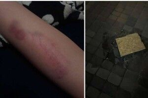 У центрі Луцька дитина провалилась у глибоку яму (Фото)