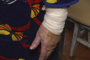 Подробиці жахливого нападу на селян Рівненщини скаженого вовка