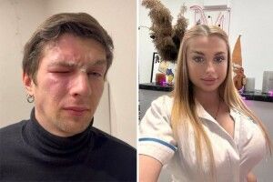 Сусідка напала на ветерана війни з газовим балончиком через зауваження