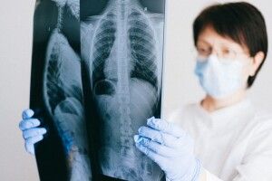 У Львові жінка пів року прожила із зубом у бронхах (Фото)