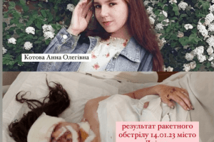 19-річна дівчина, яка залишилися без ока від удару рф по Дніпрі, збирає гроші на протезування (Фото)