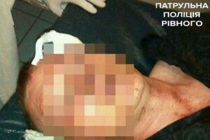 У Рівному затримали азербайджанця, який побив учасника АТО