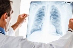 Неприємне лідерство нашої країни