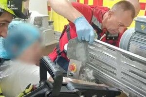 Щоб врятувати руку волинянки з пастки, викликали рятувальників