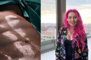 Українка з найбільшими у світі вилицями зробила кубики на пресі та прибрала жир за 160 тисяч гривень (Фото)