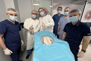 Львівські медики зробили унікальну пересадку печінки: деталі