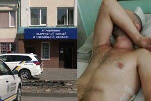 Підстрелений велосипедист у Рівному: куля влучила у ребро та розтрощила його на 12 уламків