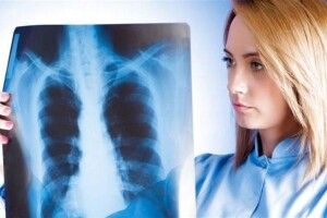 У Рівному закупили препарати від туберкульозу, одна упаковка яких вартує півмільйона гривень