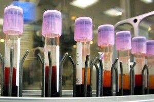 У матері померлого на Рівненщині перед Новим роком одномісячного хлопчика виявили паличку кашлюку