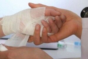 На Волині 5-річний хлопчик отримав важкі опіки