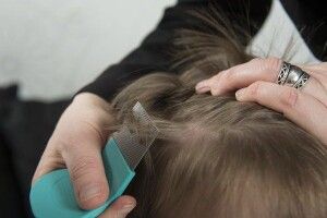 Волиняни найменше в Україні страждають від педикульозу