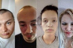 Затримано нападників на атовця Вербича у Києві, які хотіли «покарати бандерівця»